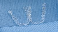 Spark Aligners